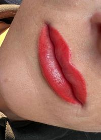 Lippenpigmentierung